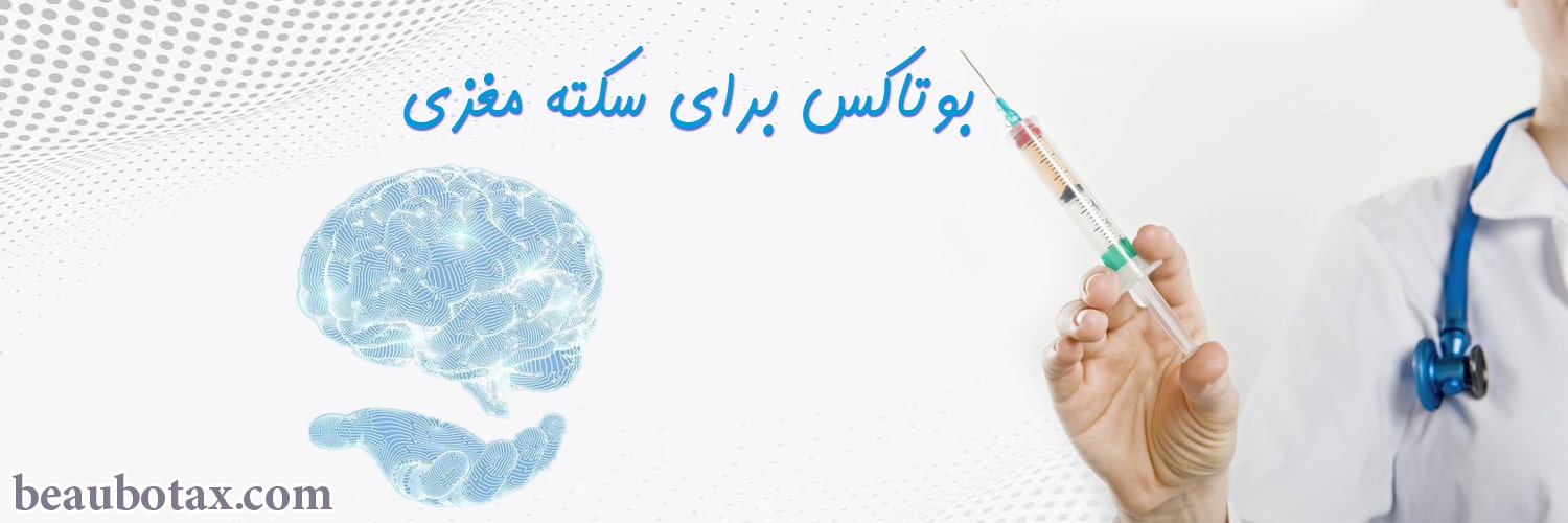 botox14-min