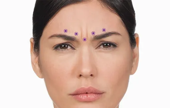 عکس تزریق خط اخم